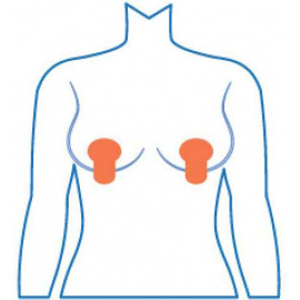 Mammopatch Gel Z vertical mammopatch-vertical-croquis