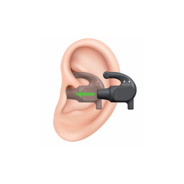 electrode-auriculaire-nerf-vague